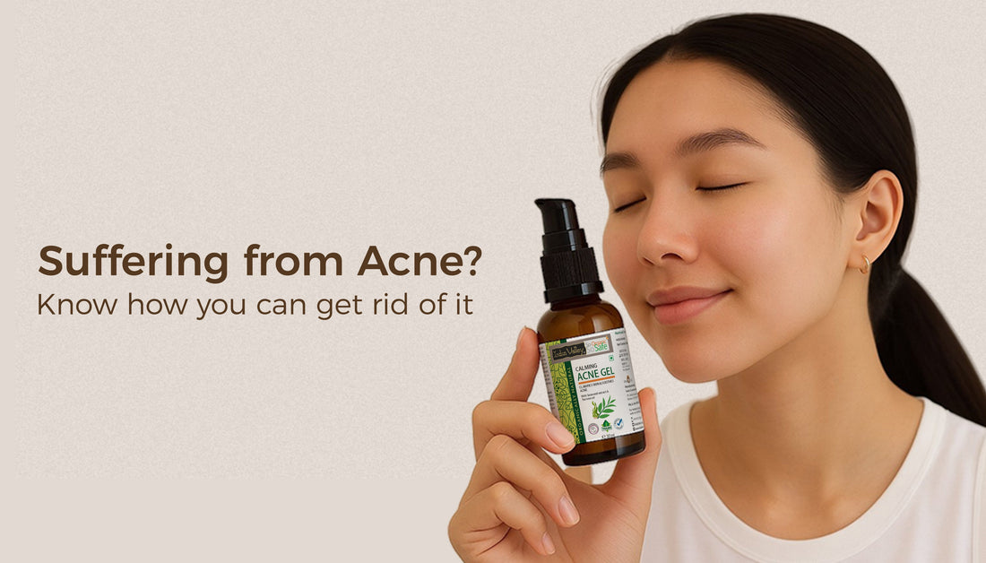 How to get rid of Acne?