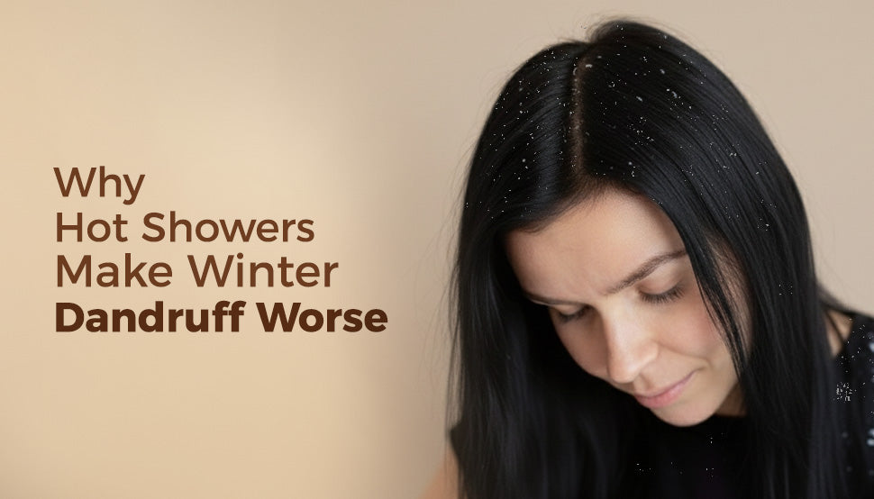 Why hot showers make Winter Dandruff Worse
