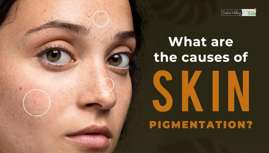 Causes of Skin Pigmentation