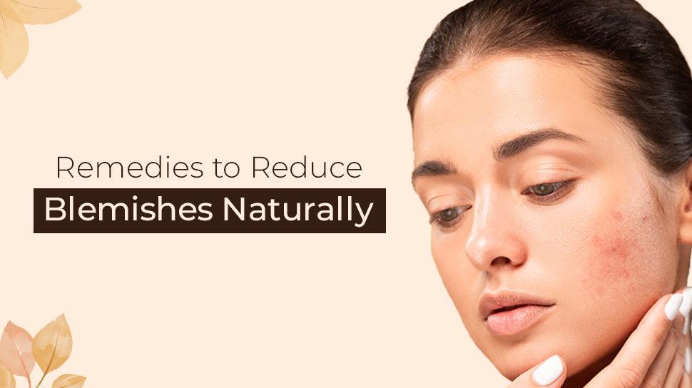 Remedies to Reduce Blemishes Naturally