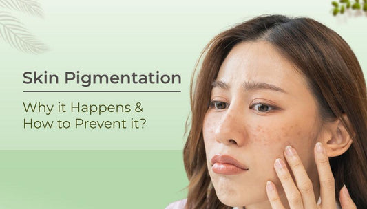Skin Pigmentation - Why it Happens and How to Treat it?