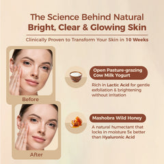 Brightening Depigmentation Gel for Reducing Pigmentation, Dark Spots and Blemishes With Cow Yogurt & Mashobra Honey - Pack of 2