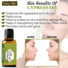 Cypress Essential Oil